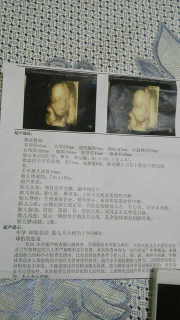 包生男孩是真的吗(包生男孩是真的吗？一起来探讨这个神秘现象)